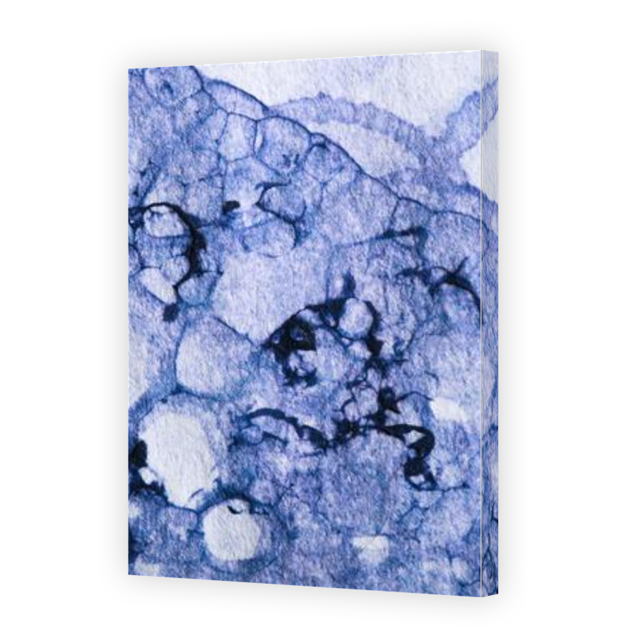 Thumbnail for Canvas - Gallery Canvas Wrap