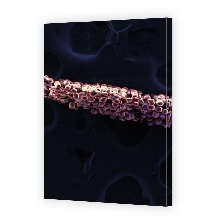 Thumbnail for Canvas - Gallery Canvas Wrap