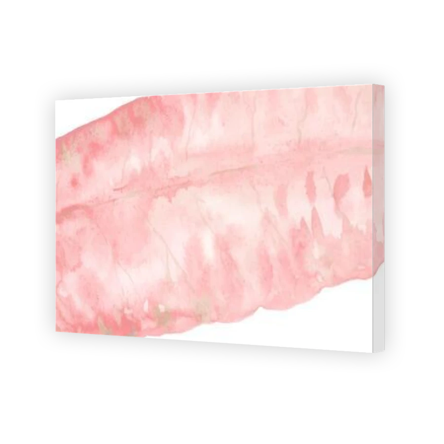 Thumbnail for Canvas - Gallery Canvas Wrap