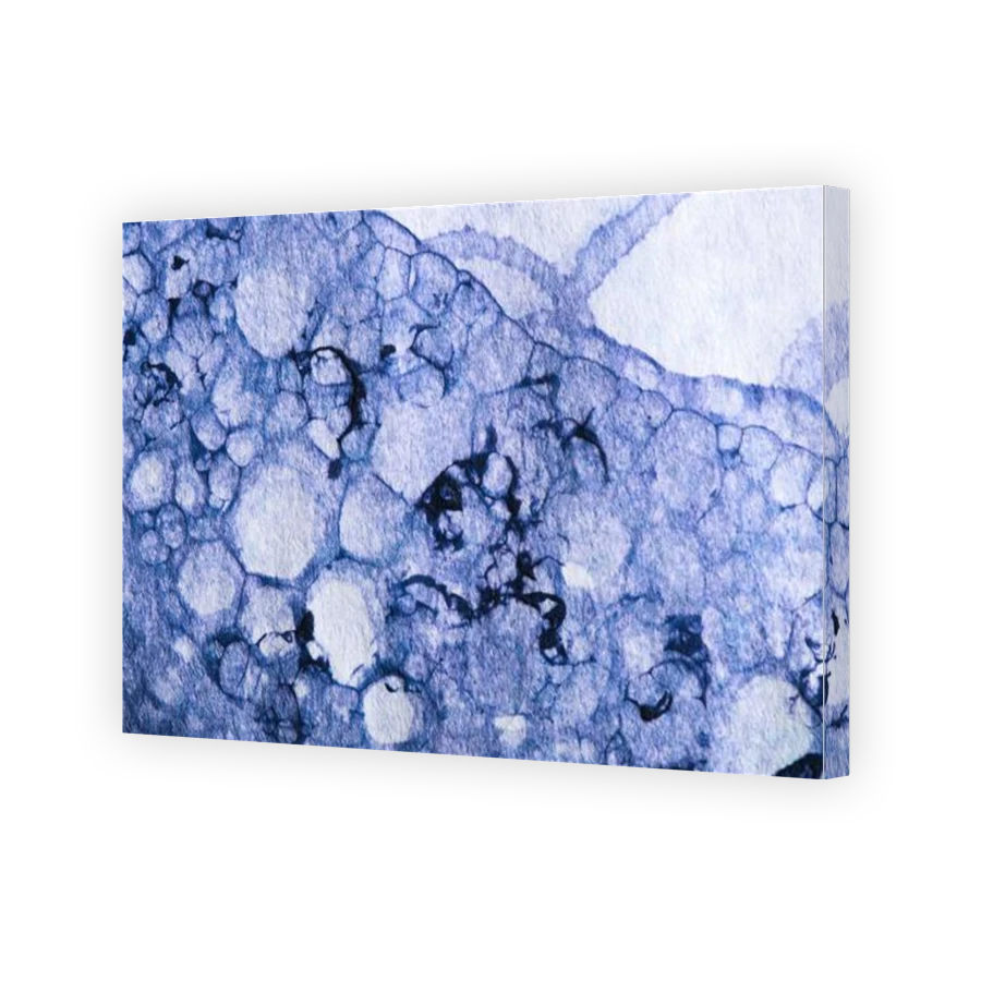 Thumbnail for Canvas - Gallery Canvas Wrap