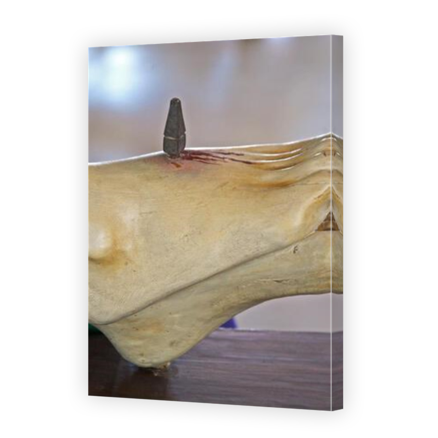 Thumbnail for Canvas - Mirror Image Canvas Wrap