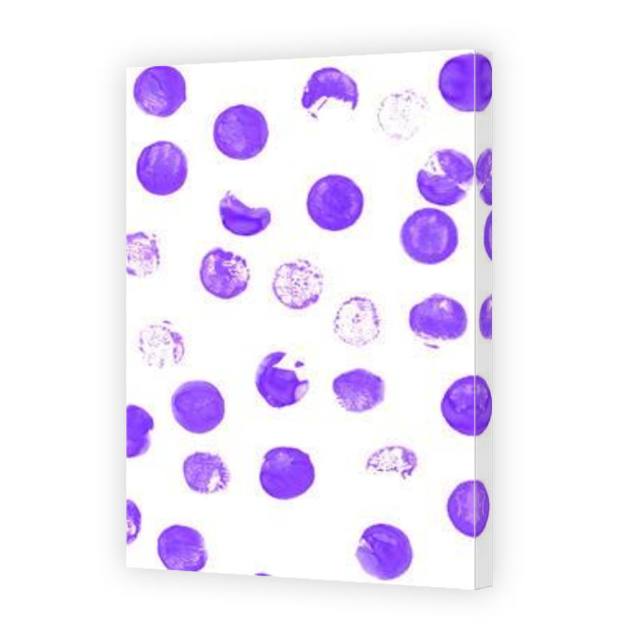 Thumbnail for Canvas - Mirror Image Canvas Wrap