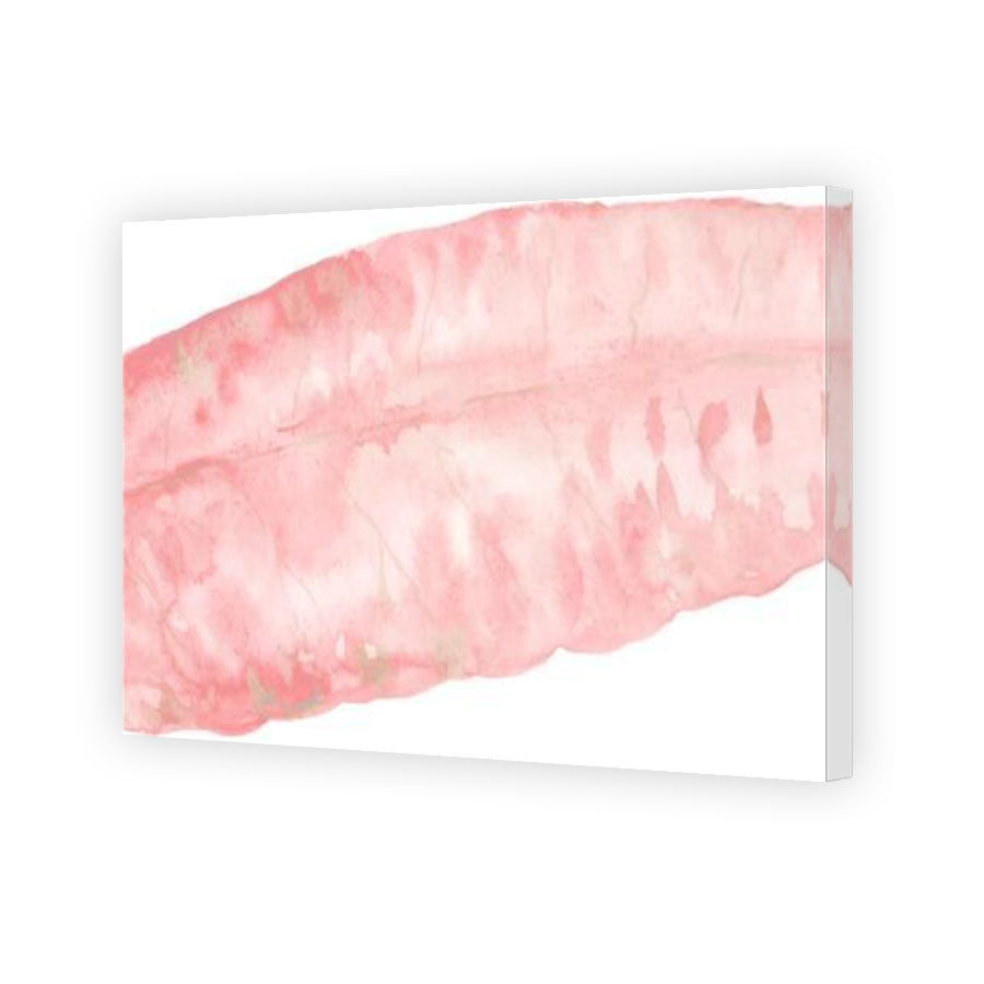Thumbnail for Canvas - Mirror Image Canvas Wrap