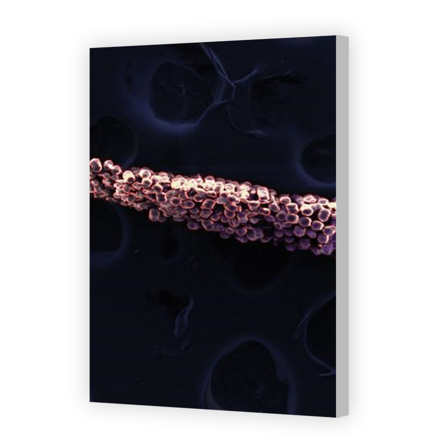Thumbnail for Canvas - Coloured Canvas Wrap