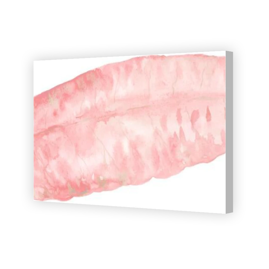 Thumbnail for Canvas - Coloured Canvas Wrap