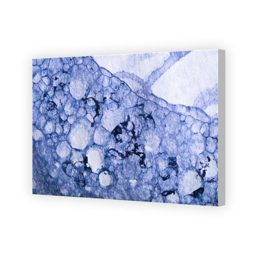 Thumbnail for Canvas - Coloured Canvas Wrap
