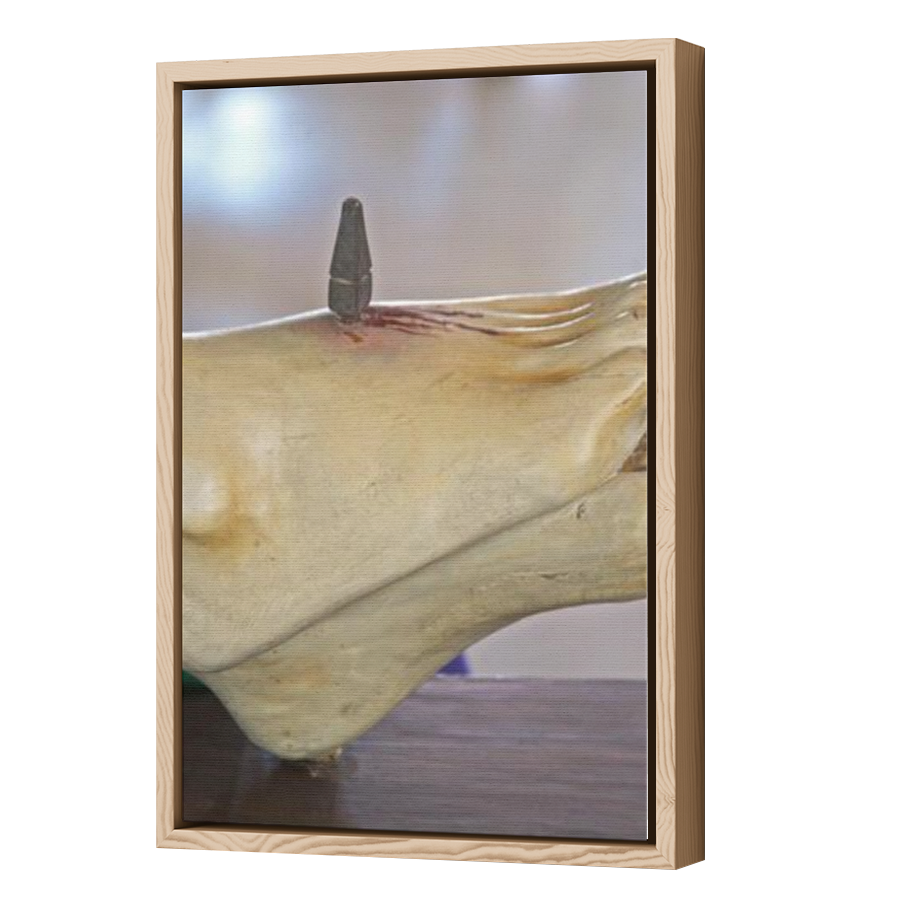 Thumbnail for Canvas - Wood Grain Floating Frame
