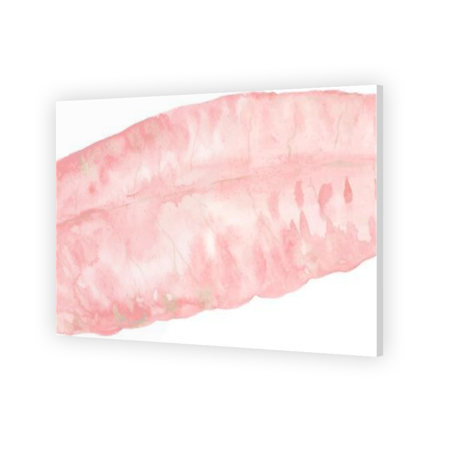 Thumbnail for Acrylic
