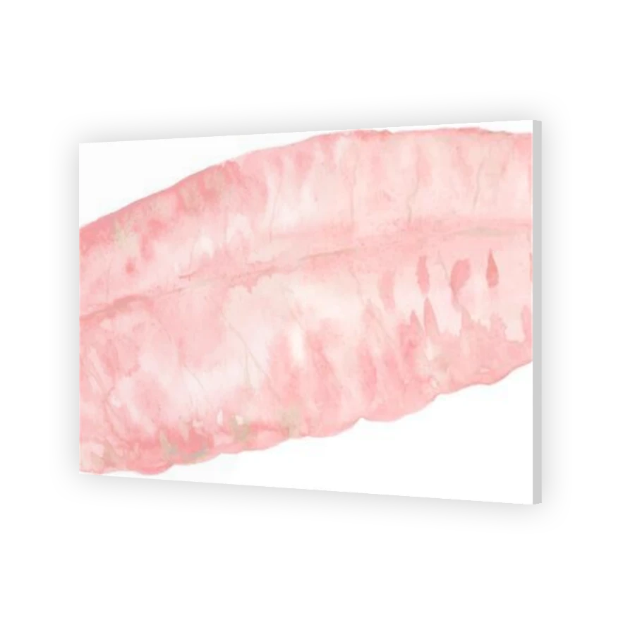 Thumbnail for Acrylic